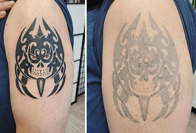 A 25 Year Gap Between Touch-Ups