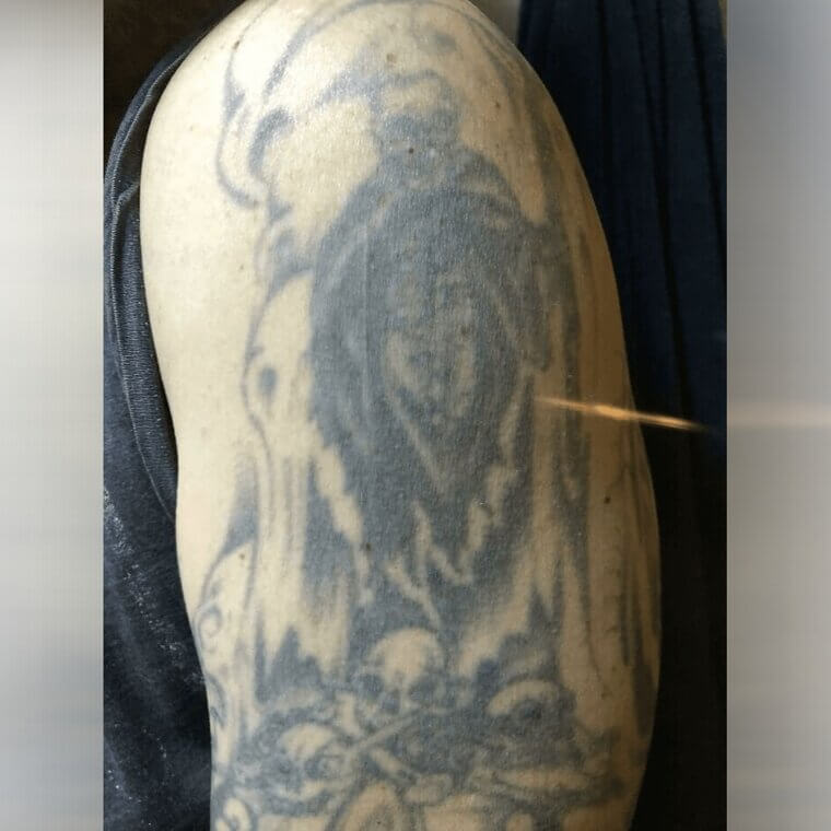 A Tattoo That's Seen Better Days